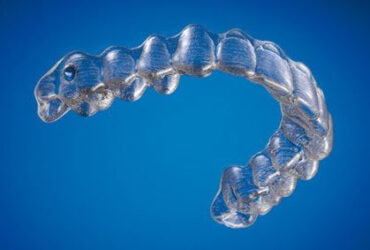 Invisalign & Braces