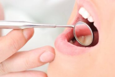 Dental Check Up & Clean