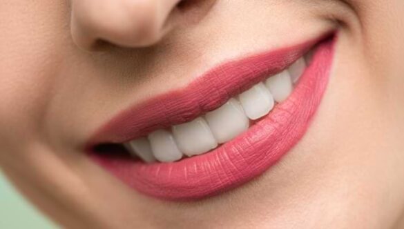 Brighter Smiles: Whitening Your Teeth & Keeping Them White