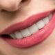 Brighter Smiles: Whitening Your Teeth & Keeping Them White