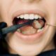 From Catching It Early to Treatment: Your Easy Guide to Periodontitis