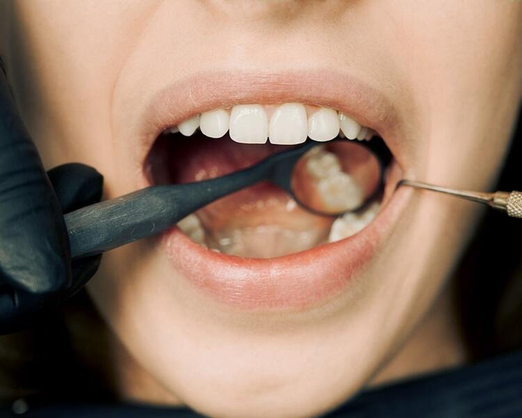 From Catching It Early to Treatment: Your Easy Guide to Periodontitis