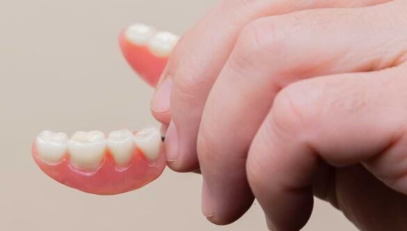 The Importance of Choosing a Good Dentist for Your Dental Bridge