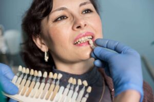How To Deal With Potential Problems & Complications of Porcelain Veneers